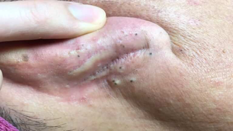 Dr Sandra Lee 108